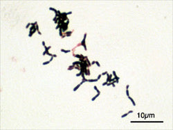 B. Bifidum microscopy image