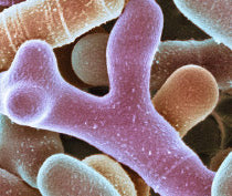 B. Animalis microscopy image