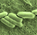 B. Lactis microscopy image