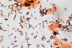L. Acidophilus microscopy image