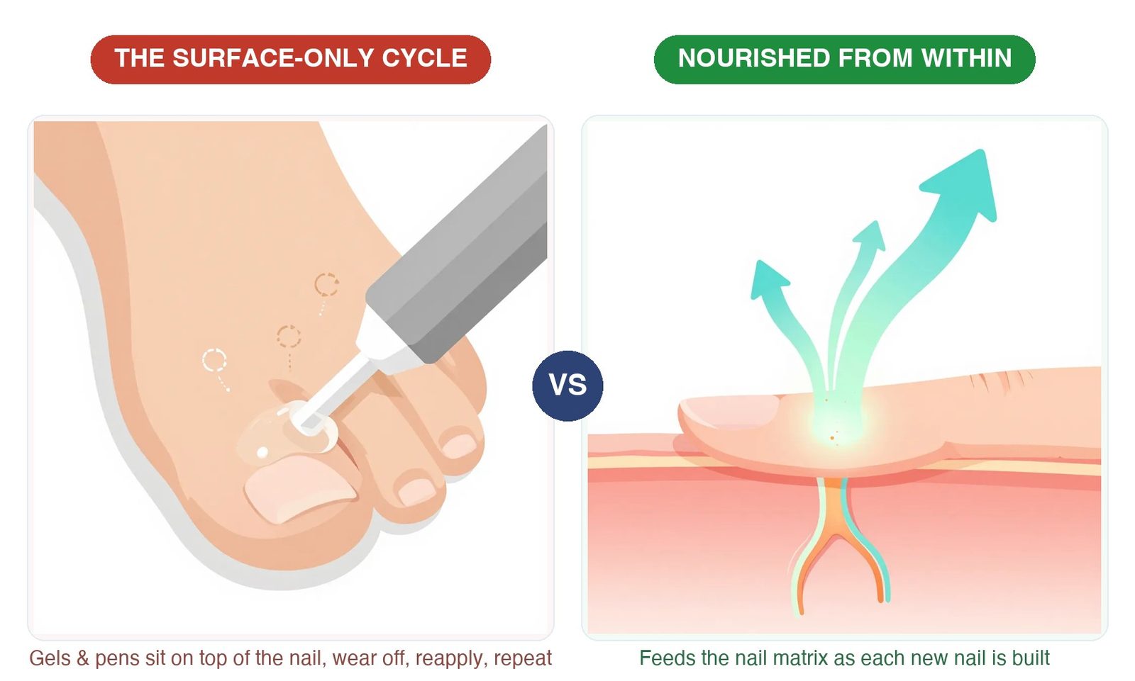 Comparison: topical products sit on top of the nail and wear off, while internal nutrition feeds the nail matrix as each new nail is built